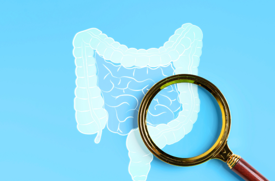 Screening colon-retto
