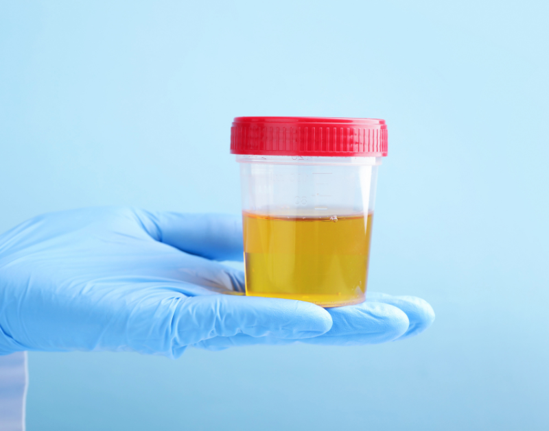 urine